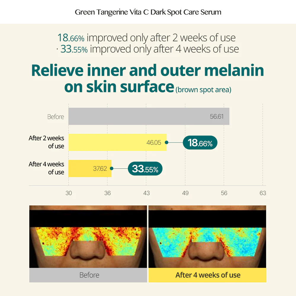 Goodal Green Tangerine Vita C Dark Spot Care Serum 40ml