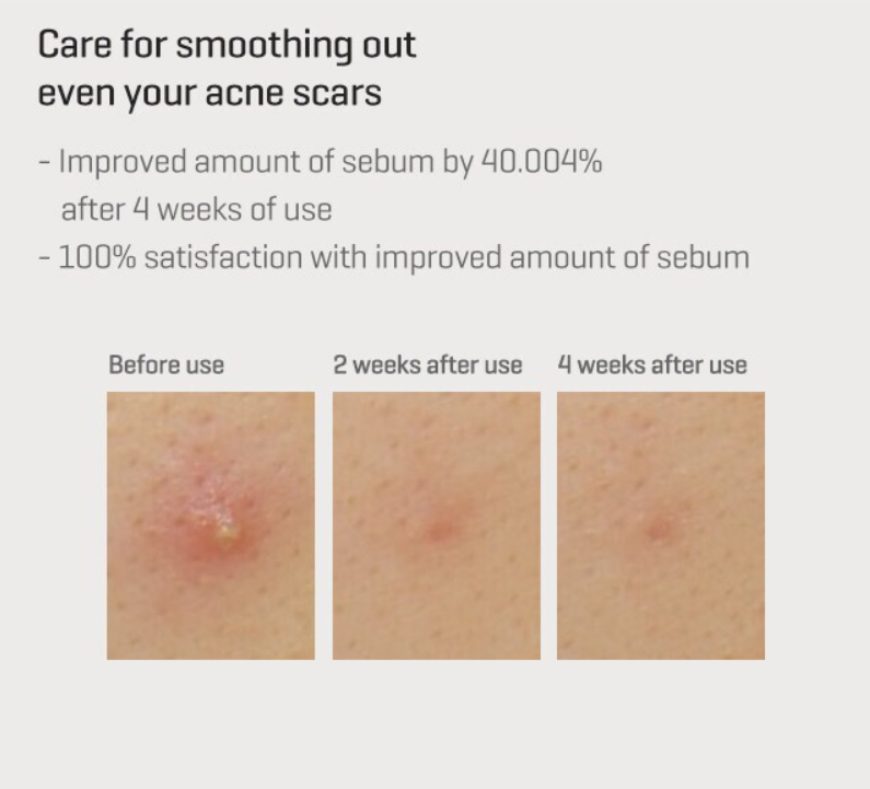 SOME BY MI Retinol Intense Reactivating Serum